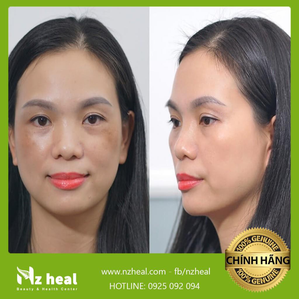 Dầu dưỡng sáng da Living Nature Radiance Night Oil 10ml | BigBuy360 - bigbuy360.vn