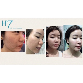 Serum Retinol Huyền Cò