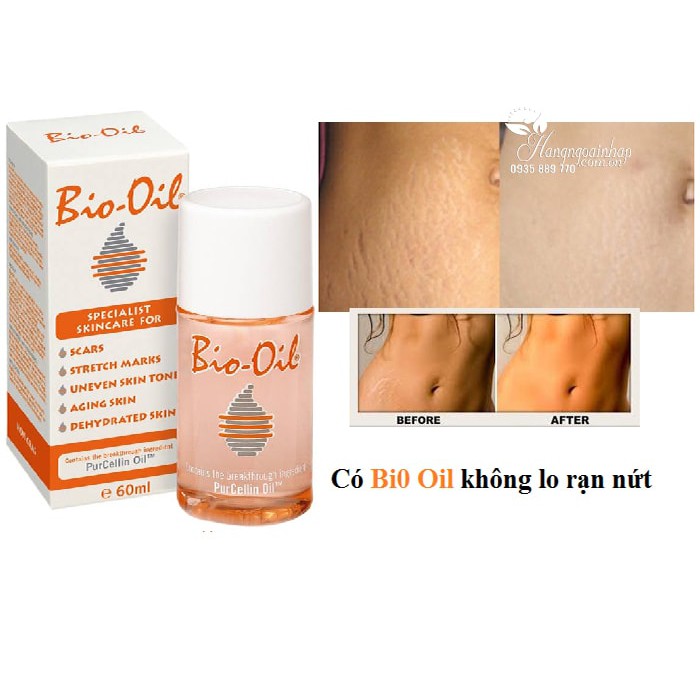 Tinh dầu Bio-Oil 60ml/125ml của Úc-Dầu chăm sóc da làm Giảm Rạn Da Và Làm Mờ Sẹo