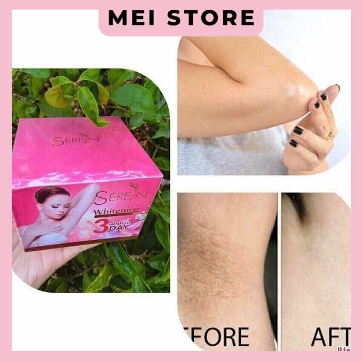 Kem thâm nách Seren 3 Day Thái Lan