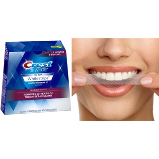 Miếng Dán Trắng Răng Crest Supreme Professional