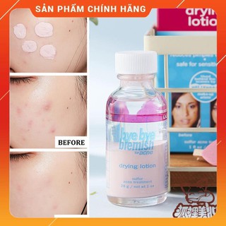 Chấm mụn Bye Bye Blemish Drying Lotion