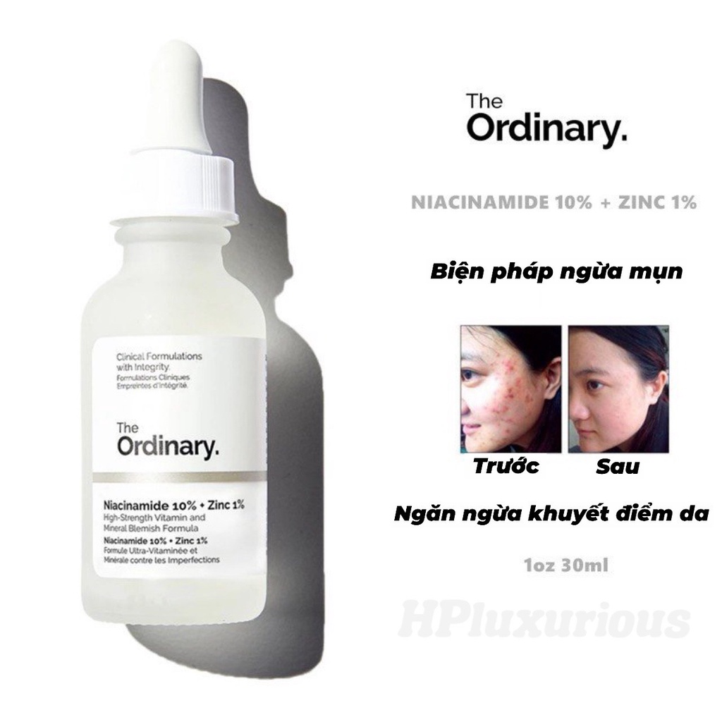 SERUM (Niacinamide10%+Zinc1%) ngừa mụn ,se khít, sáng da The Ordinary 30ml | BigBuy360 - bigbuy360.vn