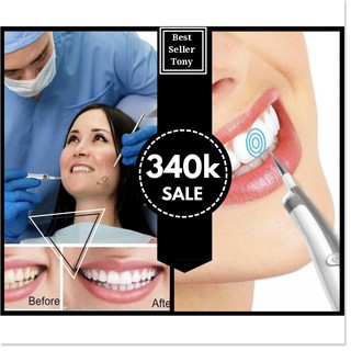 Máy lấy vôi răng cao làm trắng răng cao cấp US - Sản phẩm hot