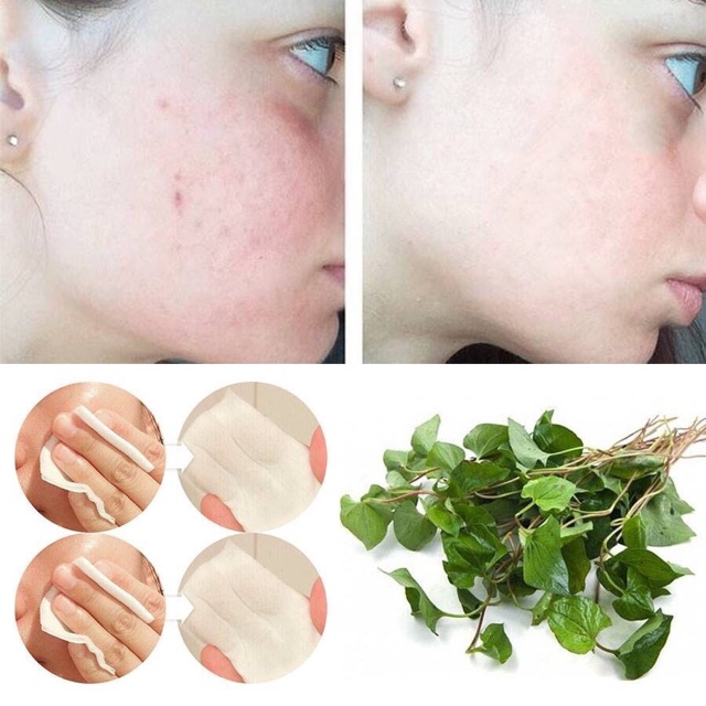Nước Hoa Hồng Diếp Cá Dokudami Skin Lotion 500ml | BigBuy360 - bigbuy360.vn