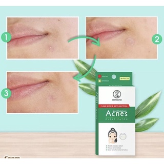 Miếng dán mụn Acnes Clear Patch