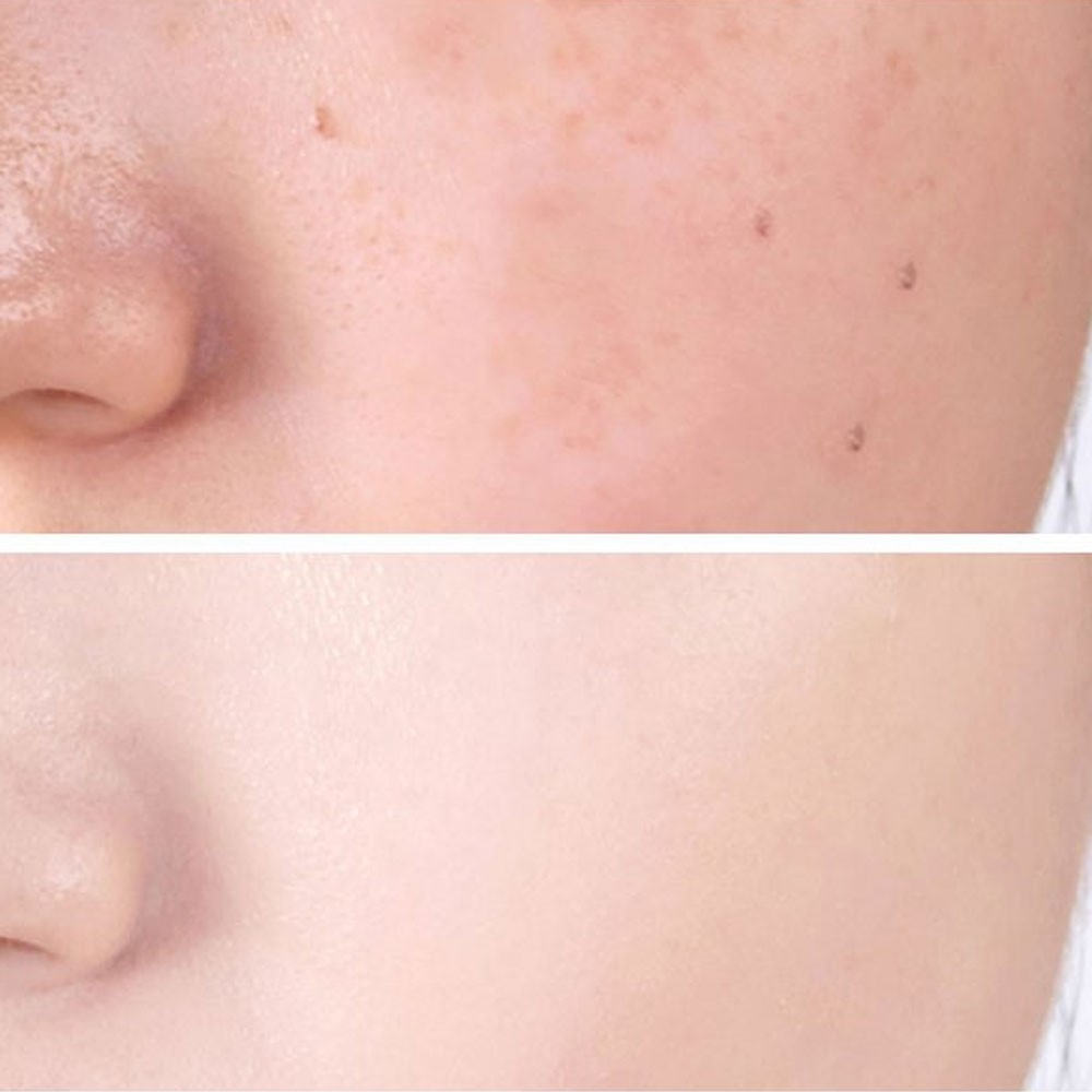 Kem che khuyết Concealer Diaoni Nội Địa Trung | BigBuy360 - bigbuy360.vn