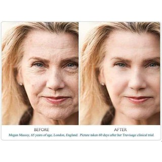 SERUM CHỐNG LÃO QUÁ RETIONOL PETER THOMAS ROTH 3%