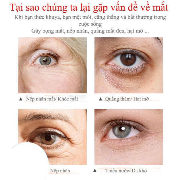 [Hàng Nhập Khẩu] VIBRANT GLAMOUR Kem Mắt Làm Mờ Quầng Thâm Quầng Mắt, Giảm Nếp Nhăn Mắt, Bổ Sung Dưỡng Chất Cho Mắt 20g