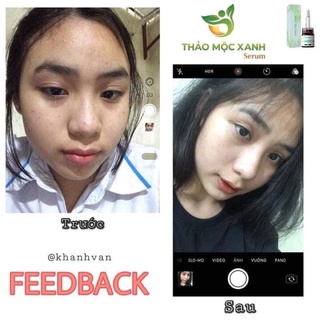 [FREESHIP] THẢO MỘC XANH 3 lọ 💥Chính Hãng💥