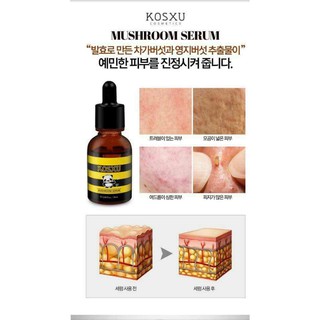 Moshroom serum KOSXU -HÀN QUỐC