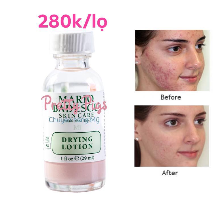 Lotion chấm mụn Mario Badescu Drying Lotion 30ml