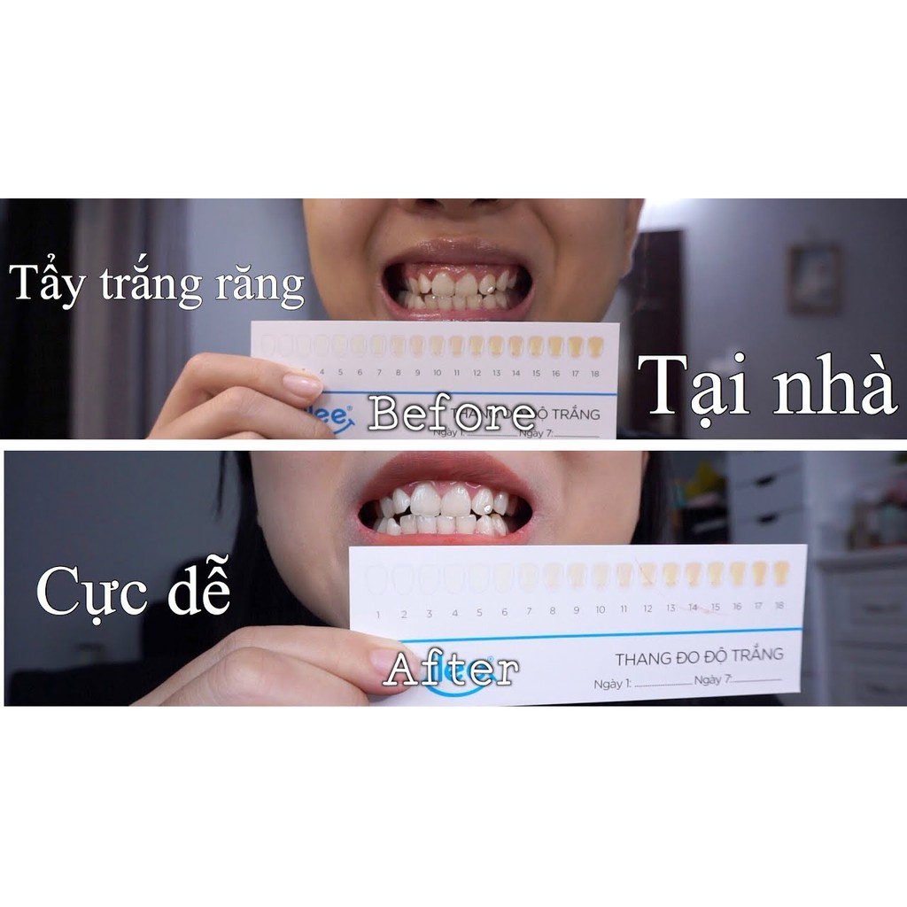 [CÓ CLIP THẬT], [Tặng Kèm Tinh Dầu Cao Câp] Tẩy Trắng Răng Tại Nhà, Răng Trắng An Toàn Smilee - Nhập Khẩu Từ Mỹ