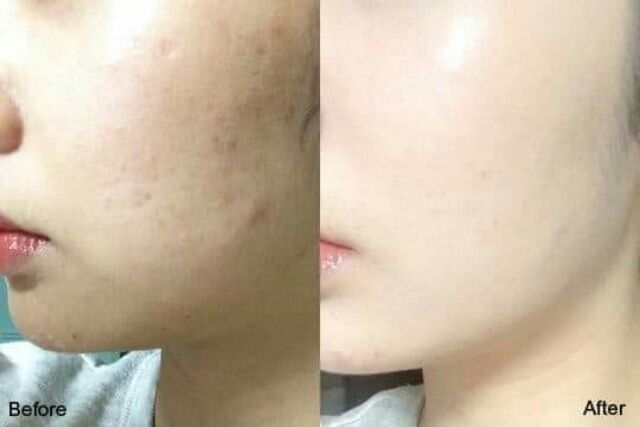 Kem Nền Kiềm Dầu PANJI (tặng kèm son #215k) | BigBuy360 - bigbuy360.vn