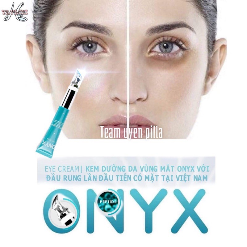 [HÀNG MỚI] Kem Dưỡng Mắt Xoá Nhăn Thâm Quầng, Bọng Mắt Với Đầu Rung Massage Tự Động ONYX COSMETICS BẢO THY | BigBuy360 - bigbuy360.vn