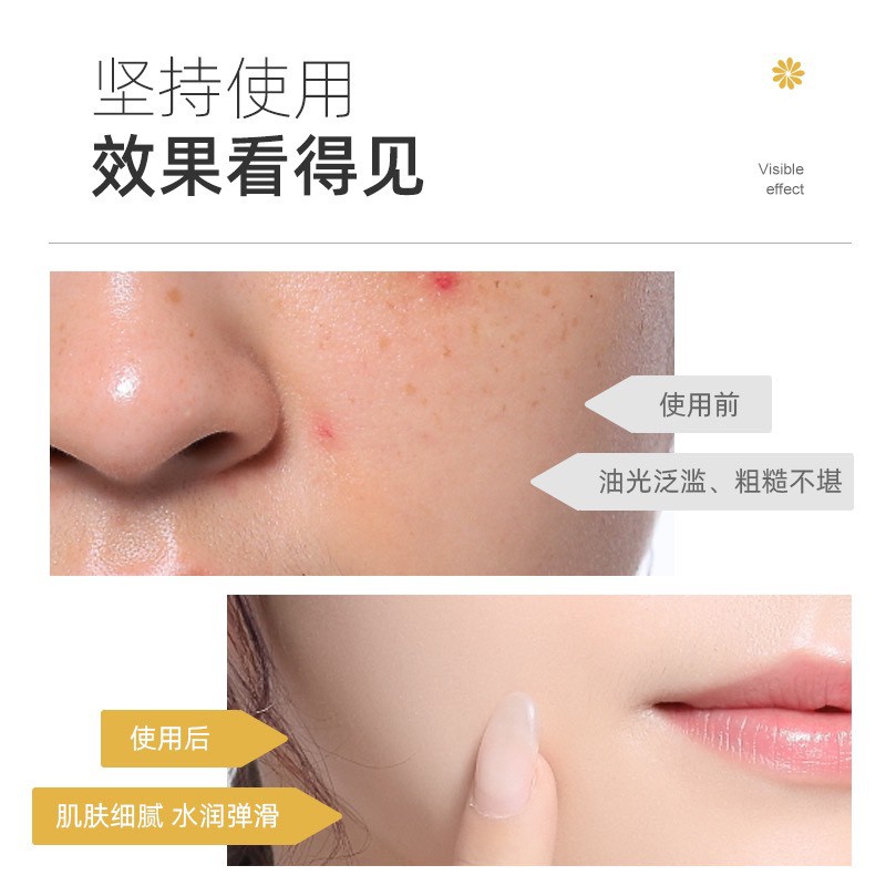 nước hoa hồng hoa cúc tr.ị mụn sáng da | BigBuy360 - bigbuy360.vn