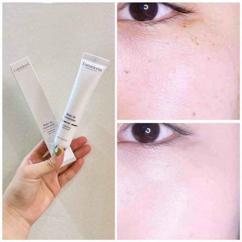 Cao nám làm giảm mờ nám Lumiderm