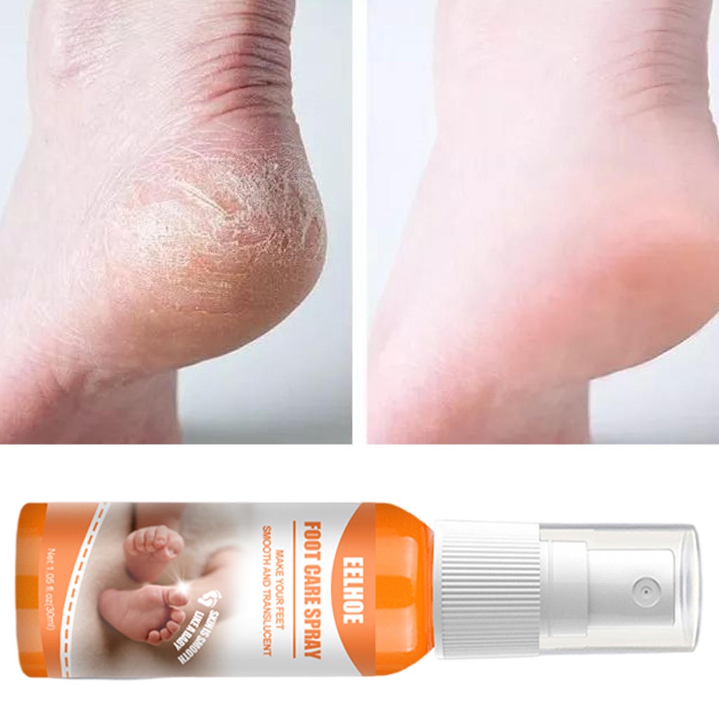 Bình xịt loại bỏ da chết cứng dưỡng ẩm cho da chân