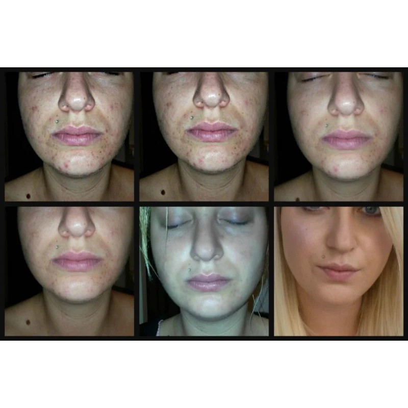 Sữa rửa mặt Cetaphil Foam Wash tạo bọt các loại