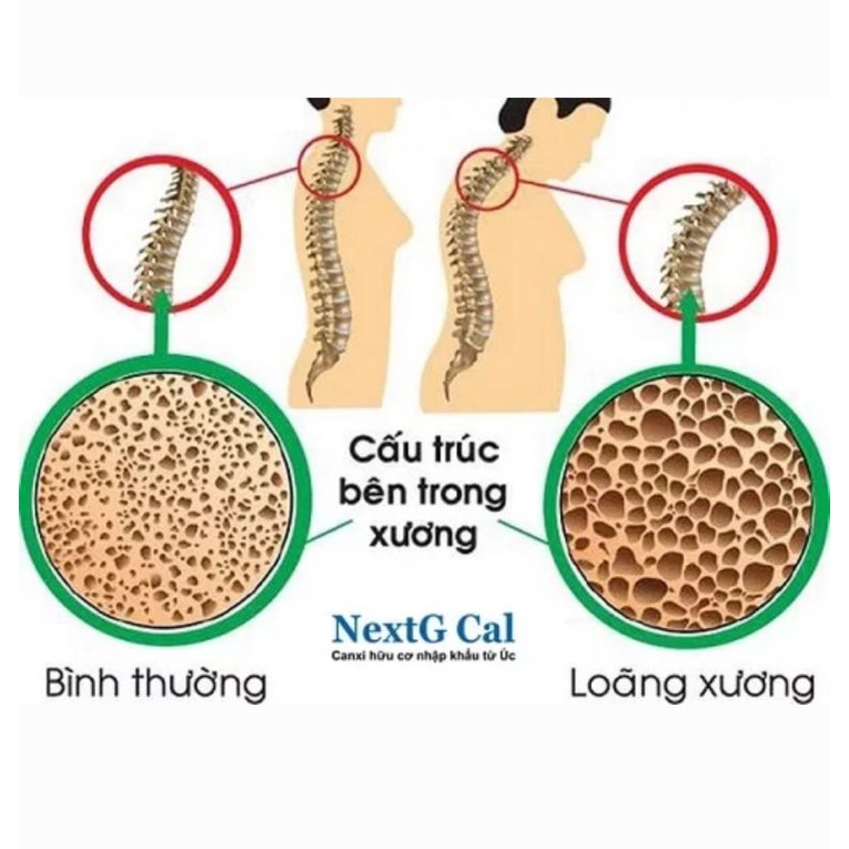 Nextg Cal canxi nhập khẩu Úc hộp 60 viên