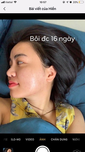 KEM MỤN BAI CAO JI giảm mụn, giảm nhờn, kiềm dầu 10g | BigBuy360 - bigbuy360.vn