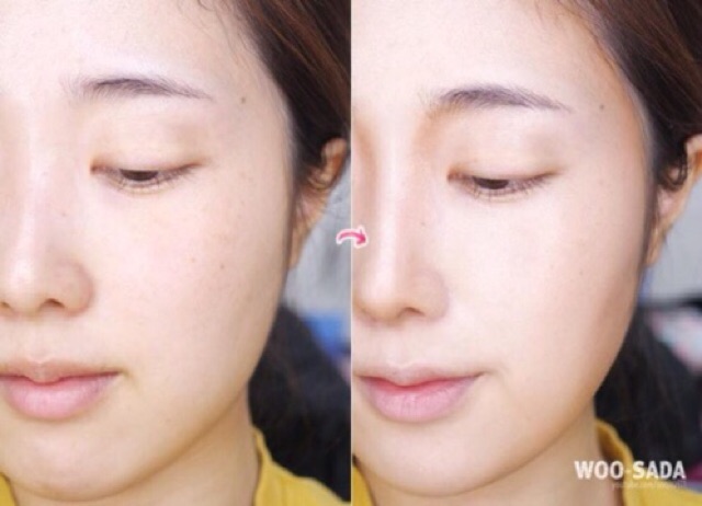 Cây tạo khối và che khuyết điểm 2 đầu | BigBuy360 - bigbuy360.vn