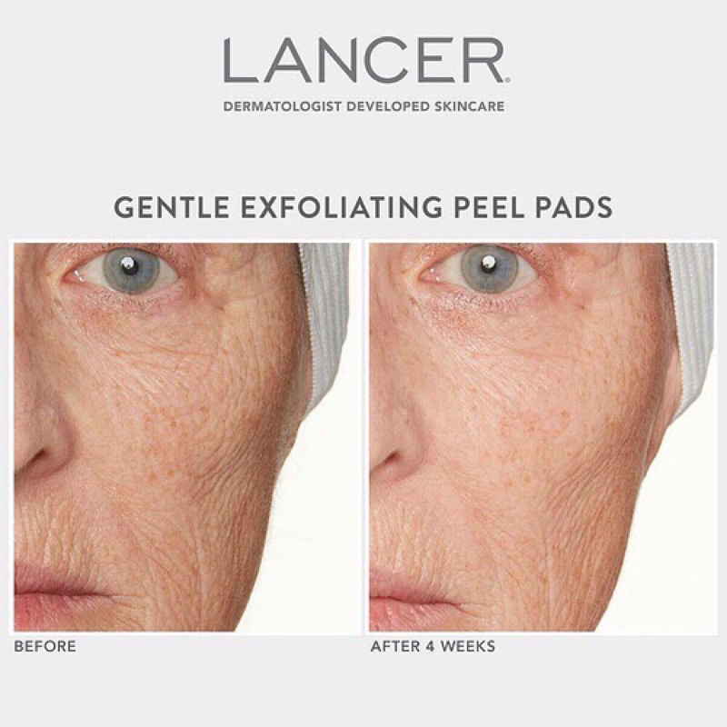 Lancer ✨ Miếng pad tẩy da chết cho da Gentle Exfoliating Peel Pad với 7% Lactic Acid + Bakuchiol