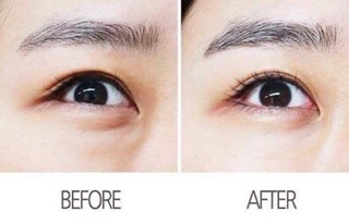 [ CÓ SẴN ] KEM MẮT AHC MẪU MỚI 2021