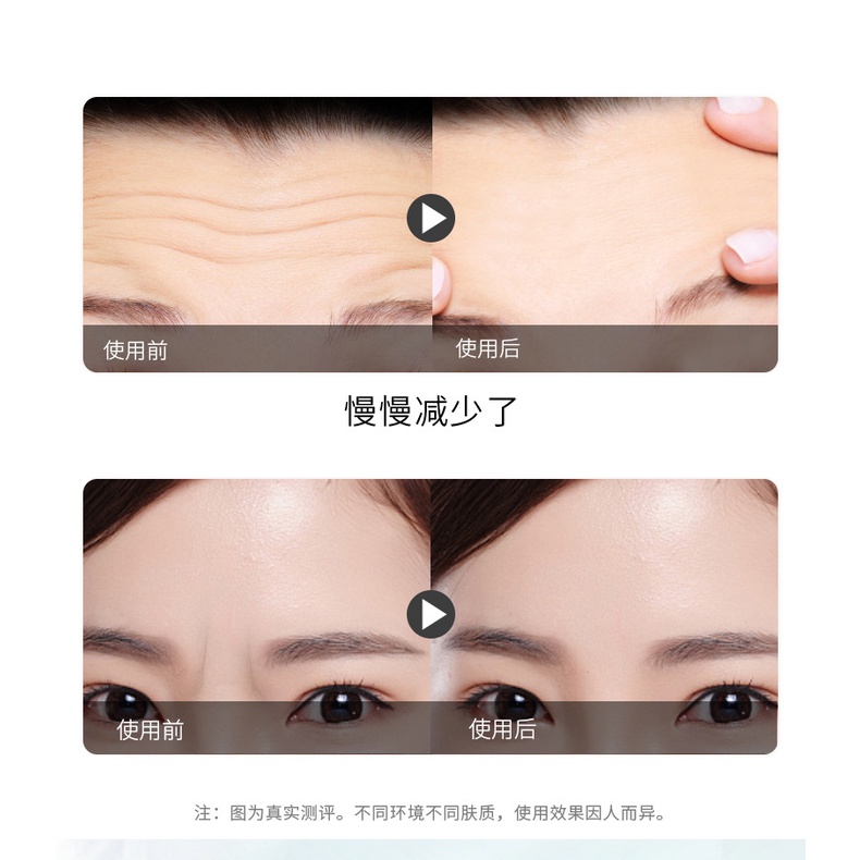 Mặt nạ hydrogel Cuifu giảm nếp nhăn dưỡng ẩm sâu cho vùng trán