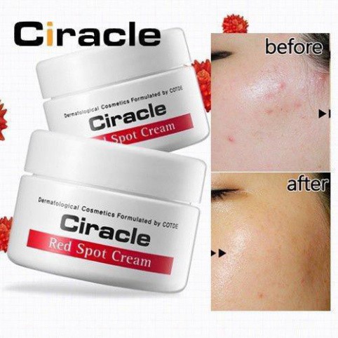 Ciracle Red Spot Cream [Sạch mụn 100%-Hàng Auth]  Kem Ciracle giảm mụn, xóa mờ vết thâm, trắng da hiệu quả