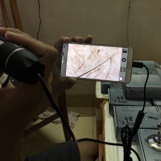 Máy soi da mini kết nối Androi