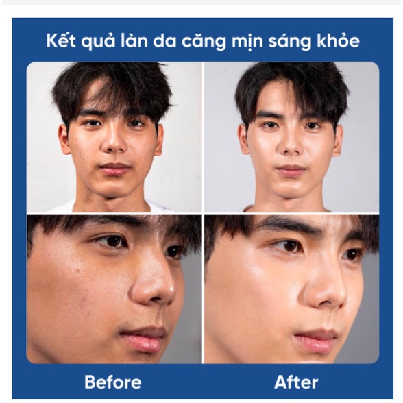 Serum dưỡng trắng da cho nam Dabo Black Force Serum For Men 120ml phân phối chính hãng tại 30 shine