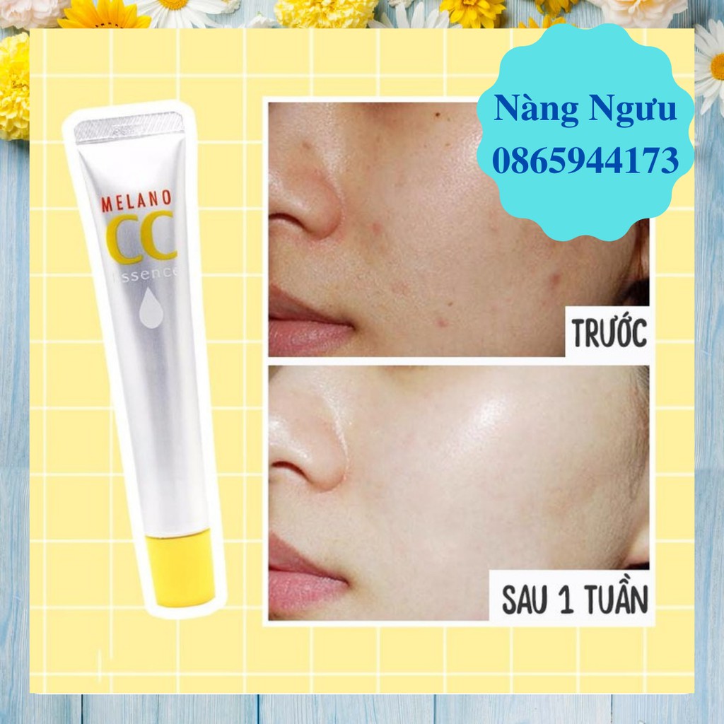 Serum Melano CC, Serum Cho Da Dầu Mụn Dưỡng Trắng, Ngăn Ngừa Mụn Và Chống Lão Hóa Da Hiệu Quả Số 1 Nhật Bản | BigBuy360 - bigbuy360.vn