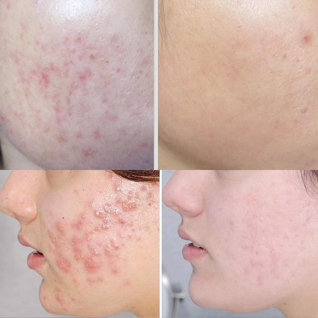 Kem Phục Hồi Da Bioderma Cicabio Cream 40ml | BigBuy360 - bigbuy360.vn