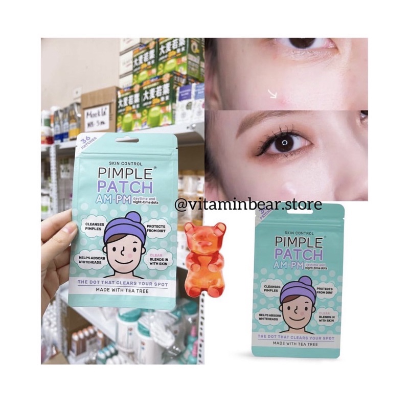 Miếng dán mụn thần thánh skin control PIMPLE PATCH AM-PM