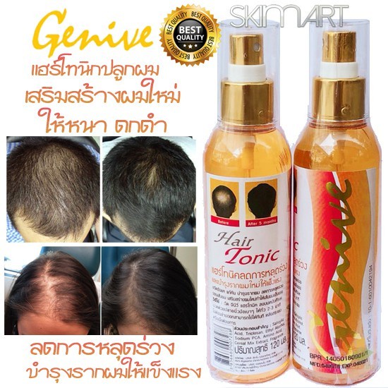 Xịt Mọc Tóc Thái Lan Genive Tonic Hair 120ml - Giảm Rụng Tóc, Kích Mọc Tóc