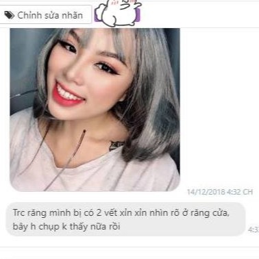 Trắng răng tại nhà Smilee Max, trắng từ 3 đến 6 tone sau 1 liệu trình, ngăn ngừa sâu răng, viêm nướu. Hàng chính hãng