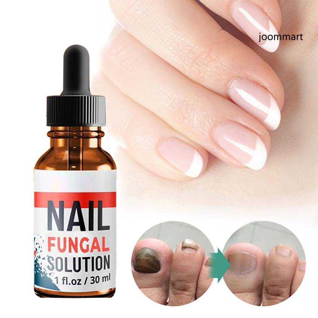 (Hàng Mới Về) Dung Dịch Điều Trị Nấm Móng Tay Chân 10ml / 20ml / 30ml