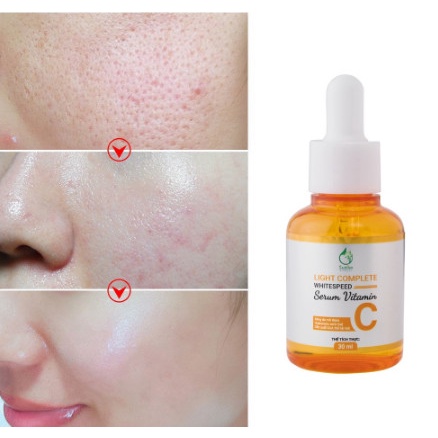 Serum sáng da mờ thâm Vitamin C 30ML SUZIKO