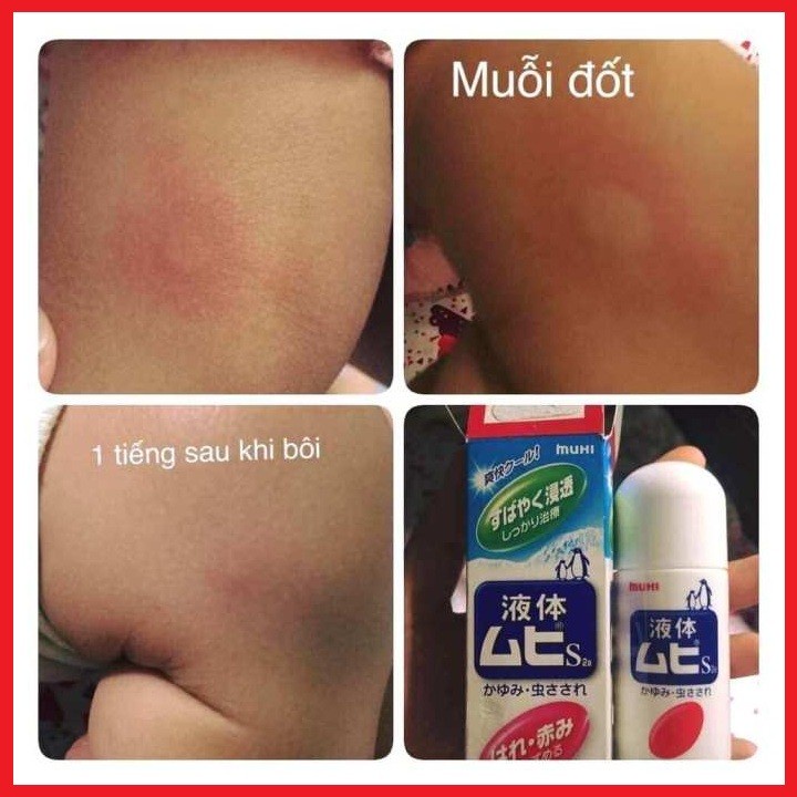 Bôi muỗi đốt Muhi 50ml CHO BÉ TỪ 6 THÁNG TUỔI