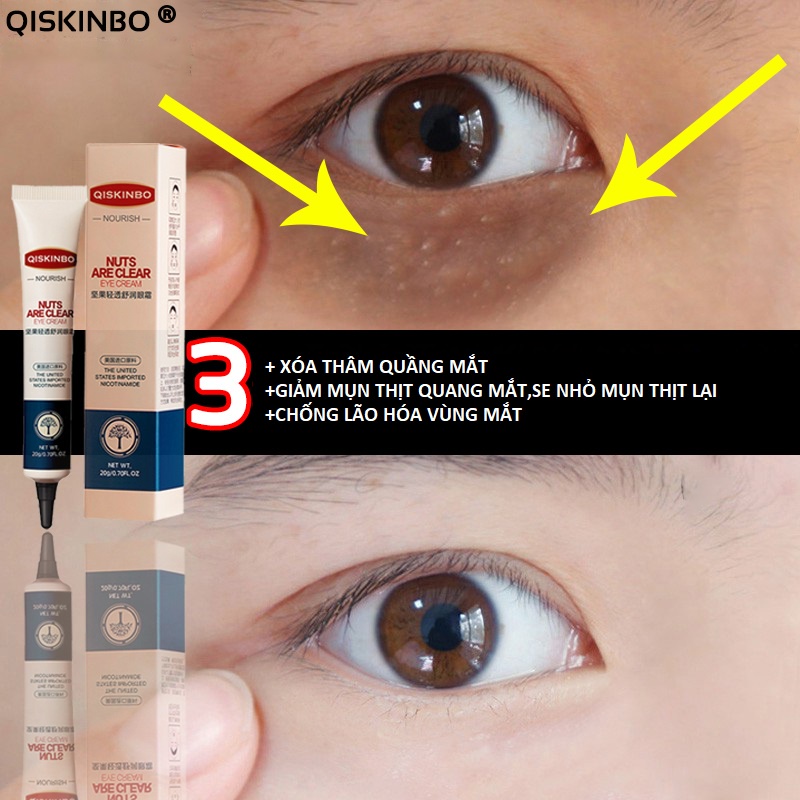 Kem xóa mụn thịt ,loại bỏ túi dưới mắt và các hạt mỡ hiệu quả,Giảm quầng thâm và làm mờ nếp nhăn