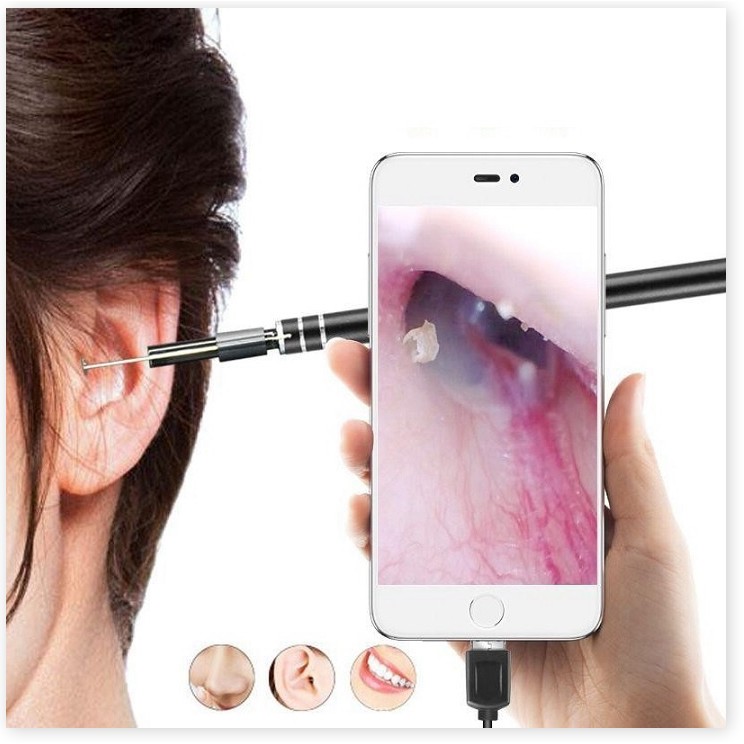 Dụng Cụ Lấy Ráy Tai Có Camera 3 Trong 1, Nội Soi Tai, Mũi Họng - Có App Kết Nối Với Điện Thoại full HD