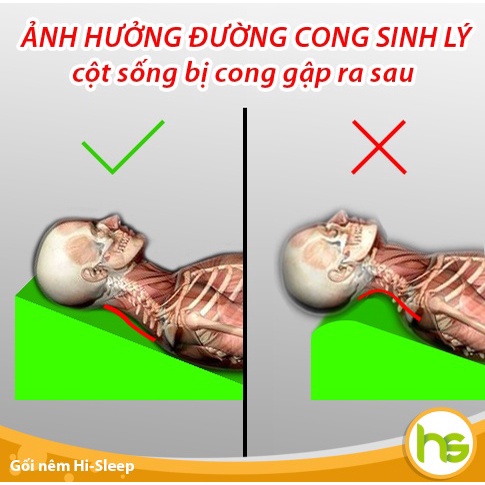 Gối chống trào ngược dạ dày cho người lớn Hi-Sleep - BS Khuyên dùng - Sx bởi đệm Kim Cương