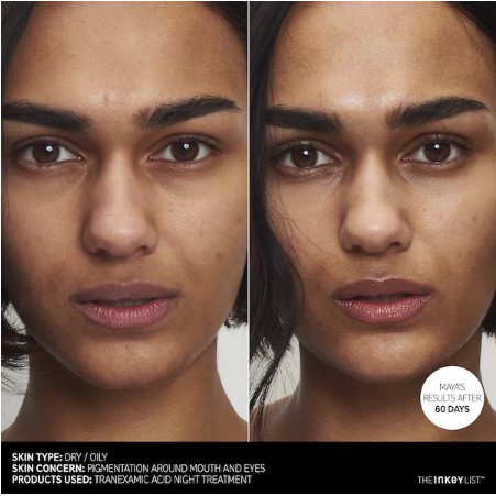 Tinh Chất Dưỡng Trắng Da Ban Đêm The INKEY List Tranexamic 30ml