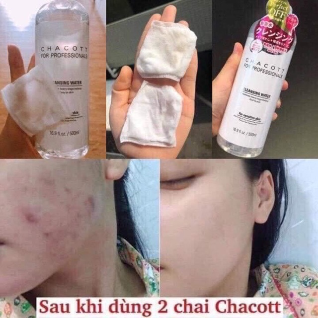 Nước tẩy trang Chacott For Professionals Cleansing Water 16.9 fl.oz.