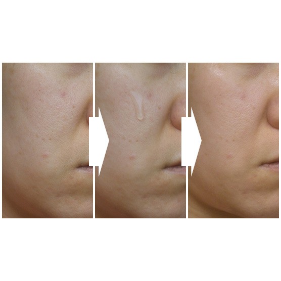Serum Vitamin C Mad Hippie Tinh Chất Làm Sáng Đều Màu Da Giảm Thâm