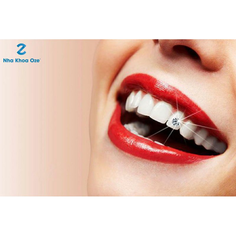 Hộp 20Viên Đá Đính Răng tặng kèm keo dán và bút