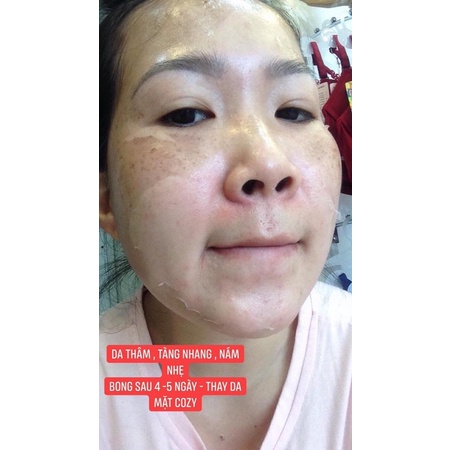 Kem nám Mesoestetic cosmelan 2 kem loại bỏ nám cao cấp