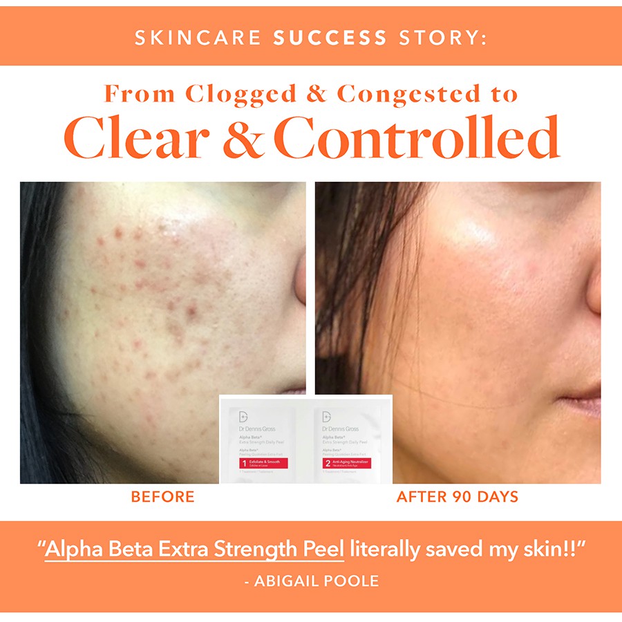 Liệu trình tẩy da chết tái tạo da DR DENNIS GROSS Alpha Beta Daily Peel