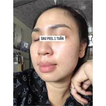 Peel da thay da sinh học tẩy tế bào chết giảm thâm sạm dùng cho mặt lưng nách vi tảo thảo mộc LUXI SKIN Sample 5ml